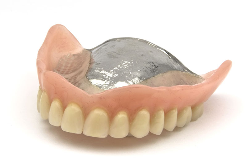 柴田歯科医院　チタン床義歯の魅力：耐久性と軽さのハイブリッド